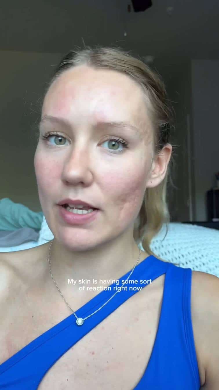 M.A.D Skincare Creator Ad